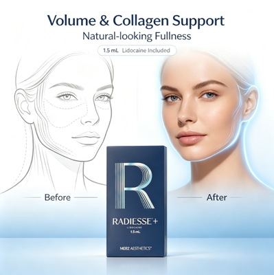 Radiesse Injection Collagen Boosting Filler For Face Immediate Correction For Deep Lines