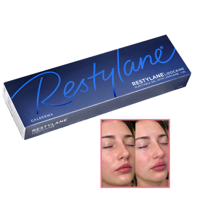 Restylane Derml Filler Ddd Volume and Smooth Folds in the Lips Hyaluronic Acid Gel Filler Injection