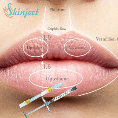 Full Lip Cheek Injectable Dermal Filler Hyaluronic Acid HA Filler 1ml 2ml 5ml