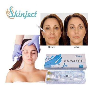 Skinject 1ml Fine Hyaluronic Acid Filler Anti Aging Anti Wrinkle Injection Dermal Filler