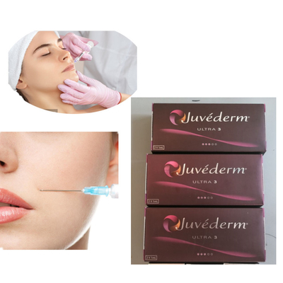 Injection Juvederm 2x1ml Ultra 3 Lip Dermal Filler 24mg/Ml