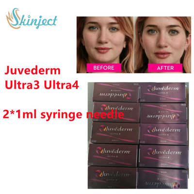Juvederm Hyaluronic Acid Dermal Filler Juvederm Lip Filler With  2x1ml Ultra3 Ultra4