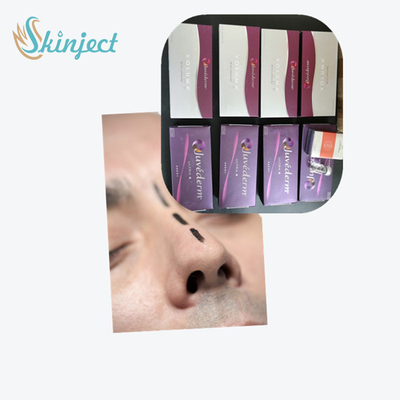 Injectable Dermal Filler For Tear Troughs Before And After Juvederm Smile Line