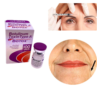 Allergan Botox 100IU Botulinum Toxin Type A For Face And Eyes Removal Wrinkles