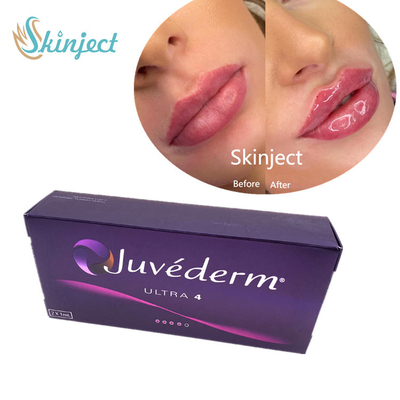 Juvederm  2*1ml Lips Filler Hyaluronic Acid Dermal Filler With Lido Ultra4