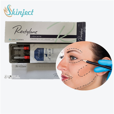  Hyaluronic Acid Breast Filler For Drooping Mouth Corners