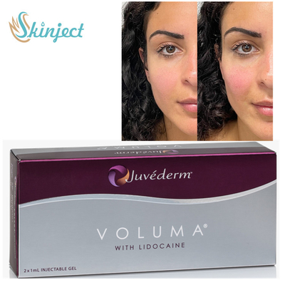 Juvederm Voluma 2x1ml Hyaluronic Acid Dermal Fillers For Cheekbone