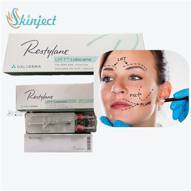 Hyaluronic Acid Facial Filler Juvederm   For Cheek Augmentation