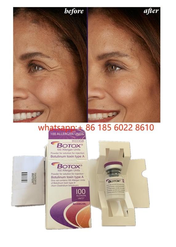 Beauty Products Allergan 100units Botulinum Toxin  For Face Wrinkles Dermal Filler