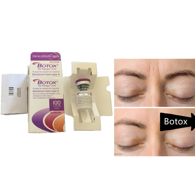 Allergan 100ui Botulinum Toxin Serum Anti Aging Product For Face Dysport