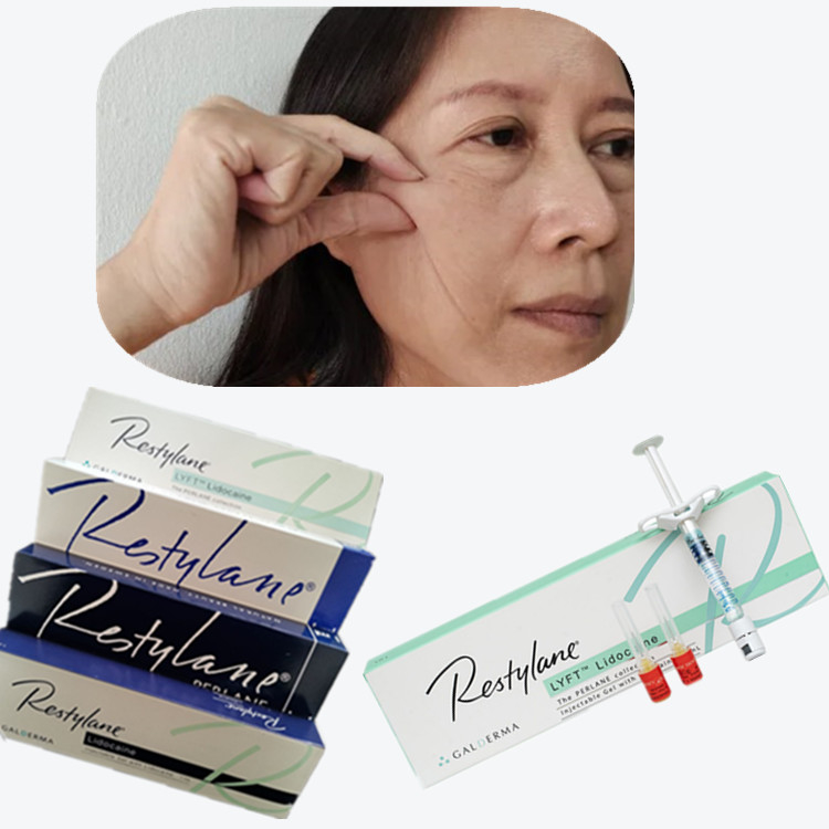 Cosmetic Cross Linked Dermal Filler HA Injection For Corners Of The Mouth