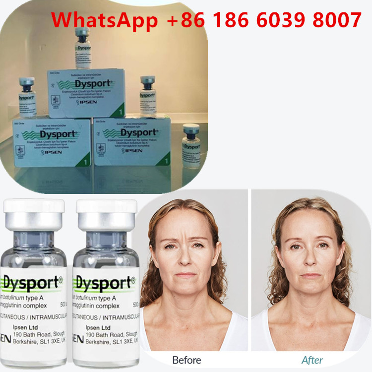Botulinum Toxin Type A 100 Units  Injection For Facial Wrinkles