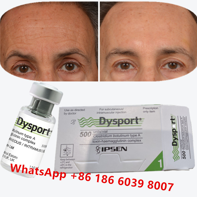 Botulinum Toxin Dysport Clostridium Botulinum Type A For Crow's Feet