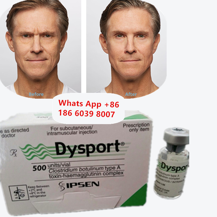 Dysport Botulinum Toxin Type A Anti-Wrinkle Freeze-Dried Powder