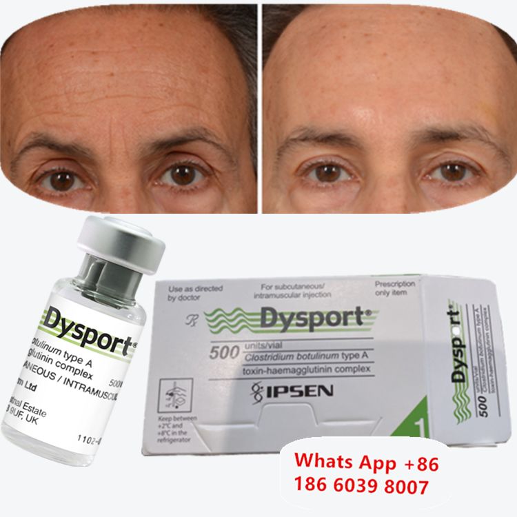 Botulinum Toxin Dysport Anti-wrinkle Freeze-Dried Powder For Couple's Mansion