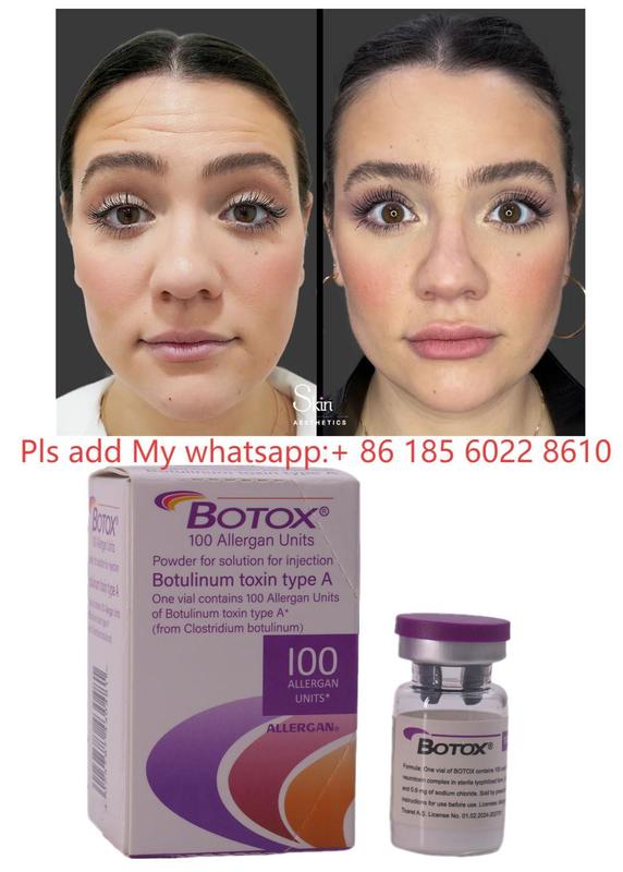 Botulax Botulinum Toxin Dysport Allergan Botox for Wrinkle Reduction and Cosmetic