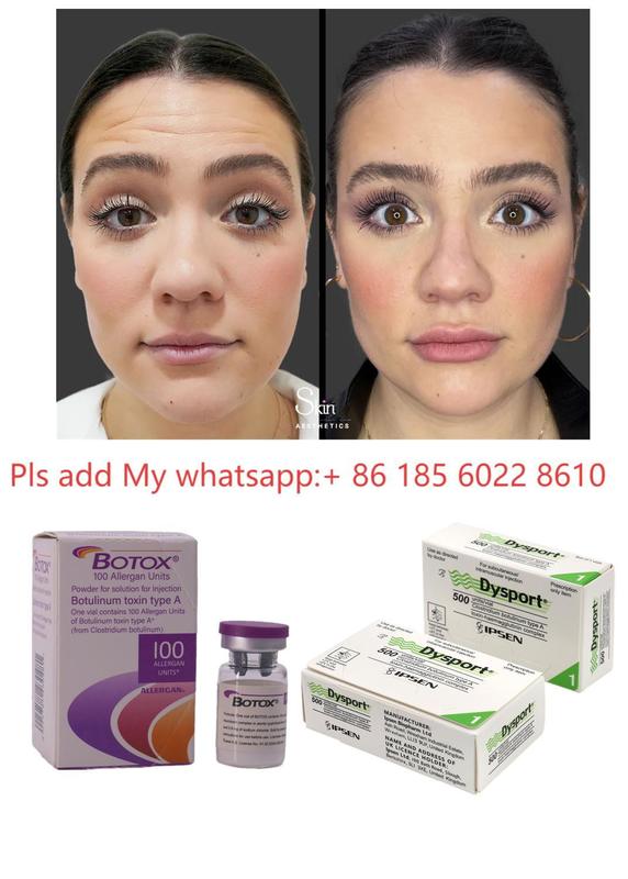 Botulinum Toxin Allergan Botox 100IU for Wrinkle Reduction and Cosmetic