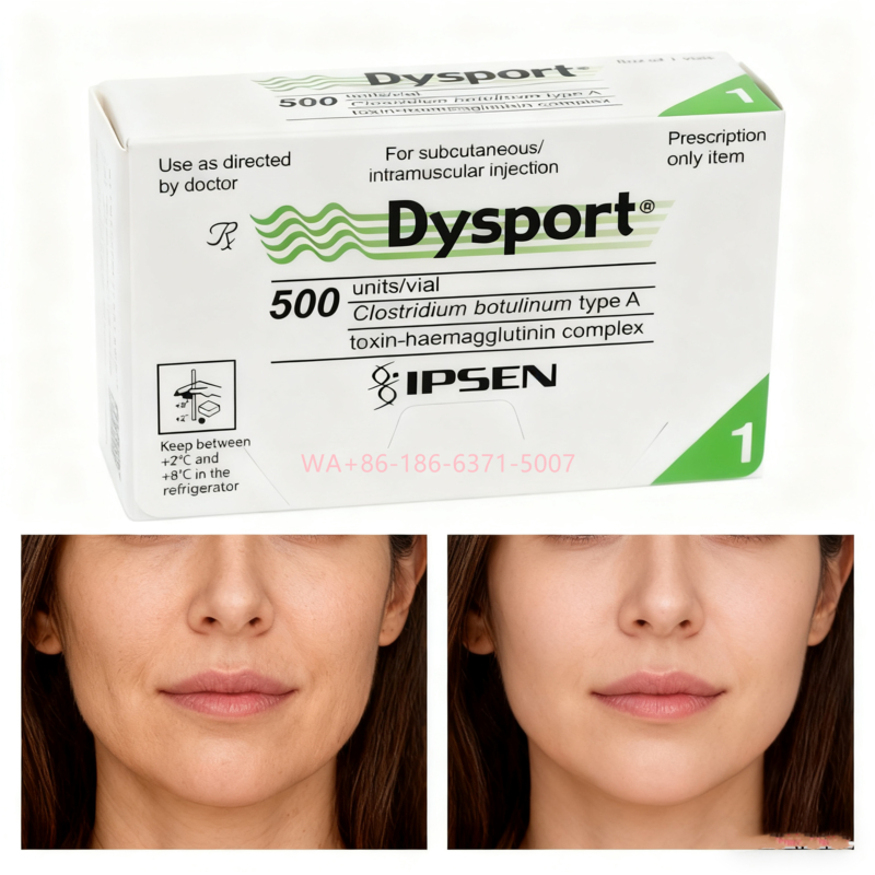 Botulinum Toxin 500U Dysport Reduce Facial Wrinkles and Restore the Skin's Smoothness