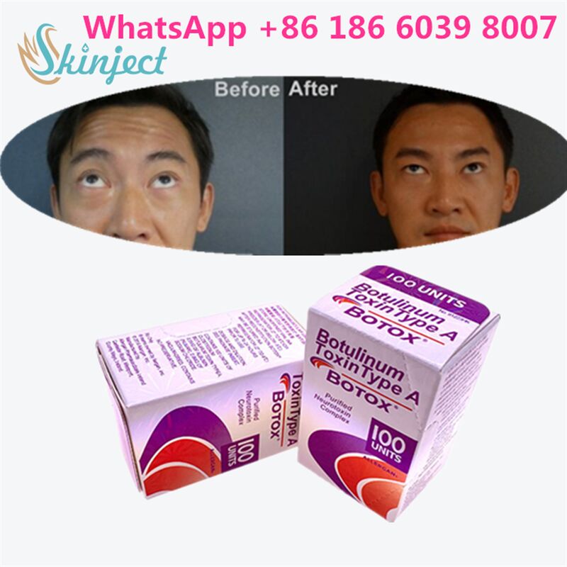 Botulinum Toxin Premium Anti-Aging for Wrinkles – Smooth Fine Lines & Youthful Skin