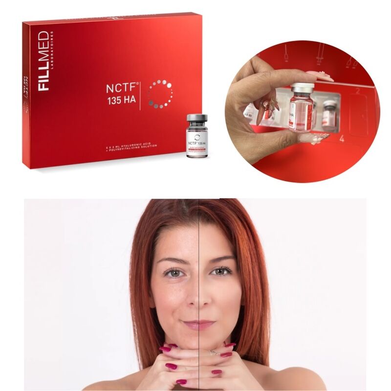 5 * 3ml Mesotherapy Cocktail Fillmed Nctf 135 Formula for Skin Rejuvenation