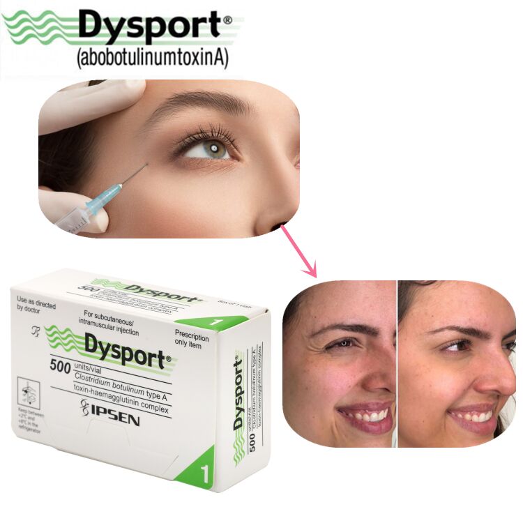 500u Dysport Facial Wrinkle Disappearance Freeze-dried Powder Processing Custom OEM Dysport