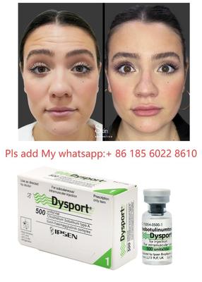 Dysport 500iu Injection Anti Wrinkle Botulinum Toxin Allergan Botulax